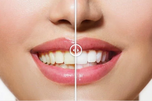Foto DentalFlex - Dentista Asti e Clinica Dentale Low Cost