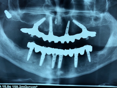 Foto Terrachini dr. Paolo | Dentista Reggio Emilia