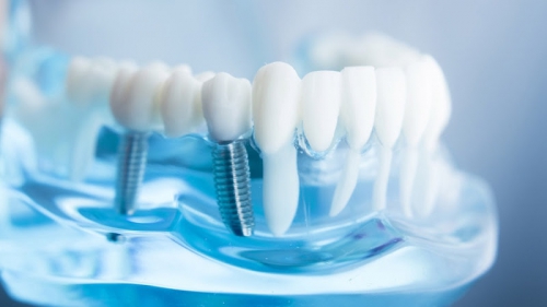 Foto Studio Odontoiatrico Cantoro - Dentista a Lecce