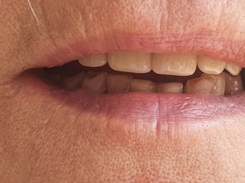 Foto Du.Val.Servizi Dentali