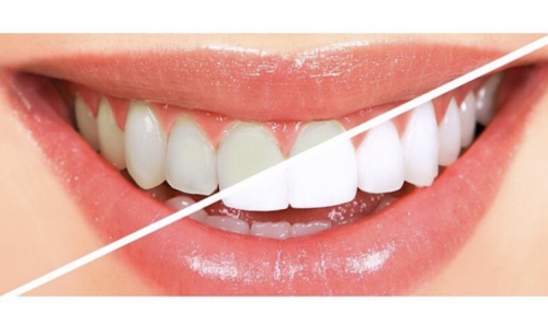 Foto Studio Dentistico Centro Laser Dentale - Dott.ssa Giulia Milia