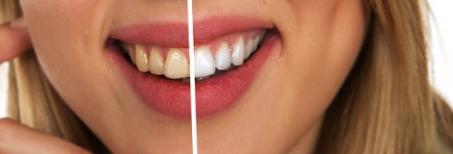 Foto Dr. Aldo Di Gregorio - Dentista Odontoiatra