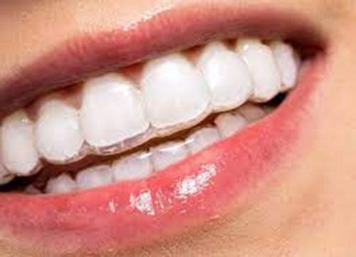 Foto Dentaldigi Centro Ambulatoriale Odontoiatrico Foto Dentaldigi Centro Ambulatoriale Odontoiatrico