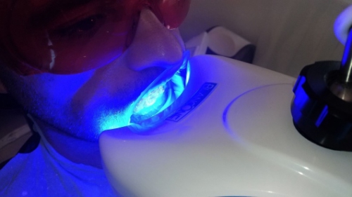 Foto Dott. Andrea Calcaprina, Dentista