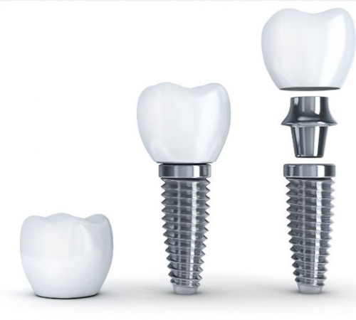 Foto Studio Dentistico Tossici Dott.ssa Monica