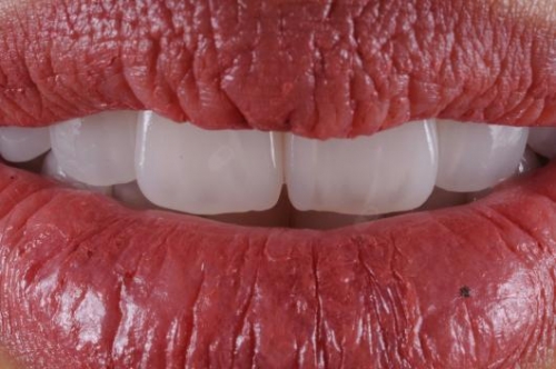 Foto Dr. Alvaro Gusmara, dentista