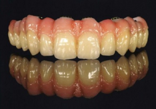 Foto Studio Dentistico Dott. Rezzonico Anthony Dentista - Monte San Vito Foto Studio Dentistico Dott. Rezzonico Anthony Dentista - Monte San Vito
