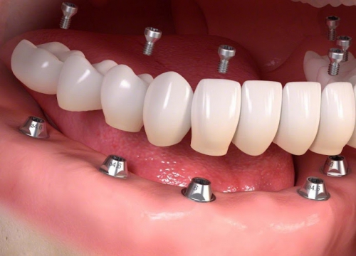 Foto Orthosalus Srl ,Odontoiatria Specialistica
